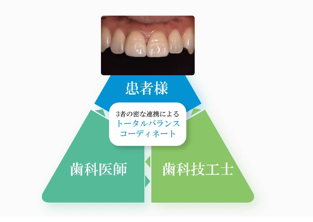 5：歯科技工士との連携によるトータルバランスコーディネート