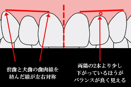 ジンジバルライン