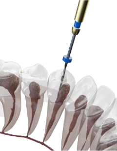 当院からのお約束根管治療へのこだわり