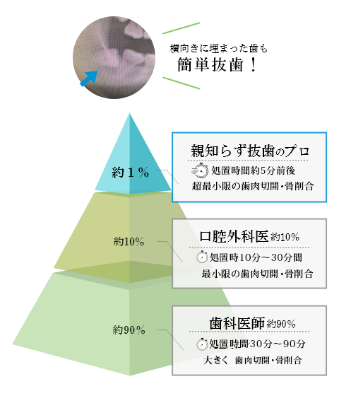 横向きに埋まった歯も簡単抜歯！