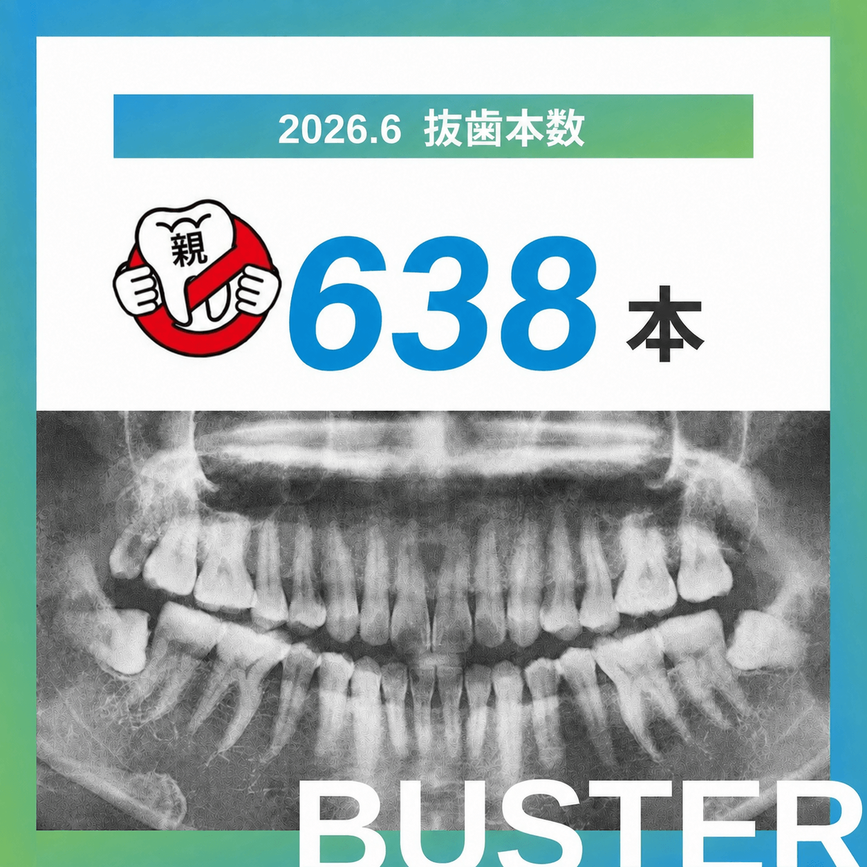 2026年6月の抜歯報告：638本 / 2026年累計：3,767本