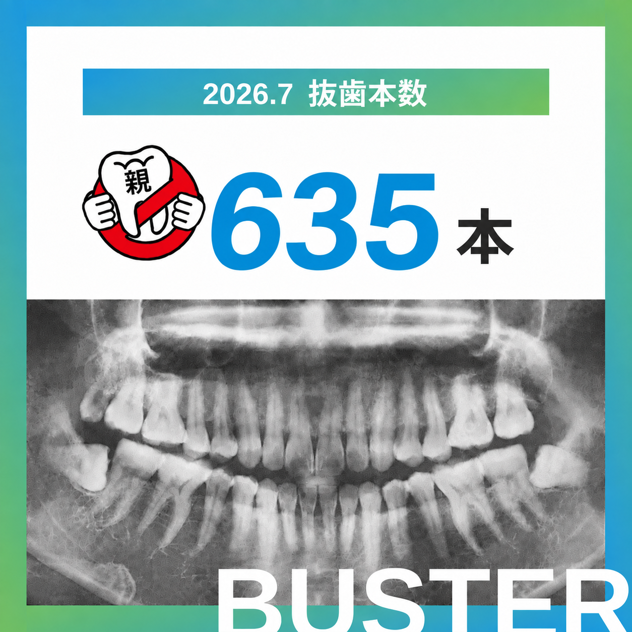 2026年7月の抜歯報告：635本 / 2026年累計：4,402本